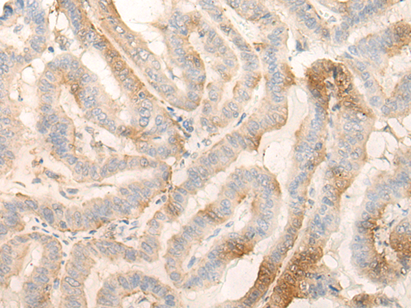 Rabbit Polyclonal Antibody to MPPED2