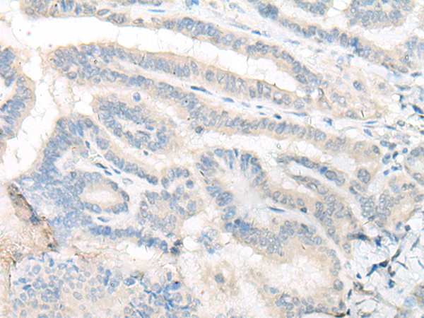 Rabbit Polyclonal Antibody to MR1