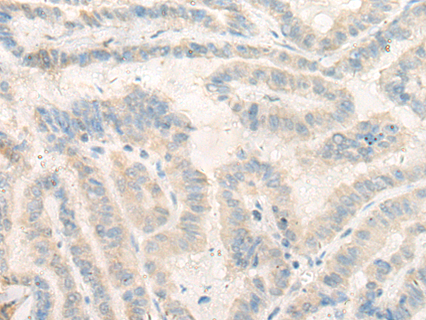 Rabbit Polyclonal Antibody to NOSIP