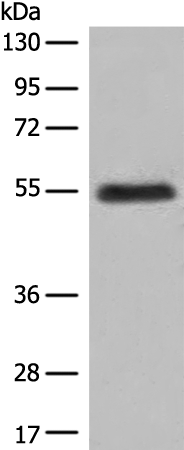 Rabbit Polyclonal Antibody to GK5
