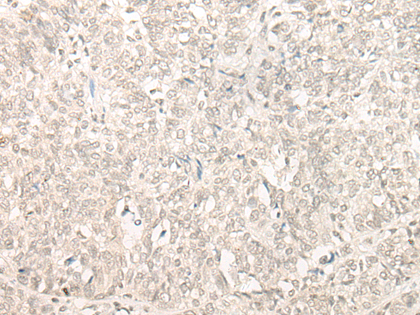 Rabbit Polyclonal Antibody to INTS11