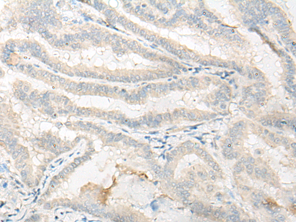 Rabbit Polyclonal Antibody to DNASE1L1