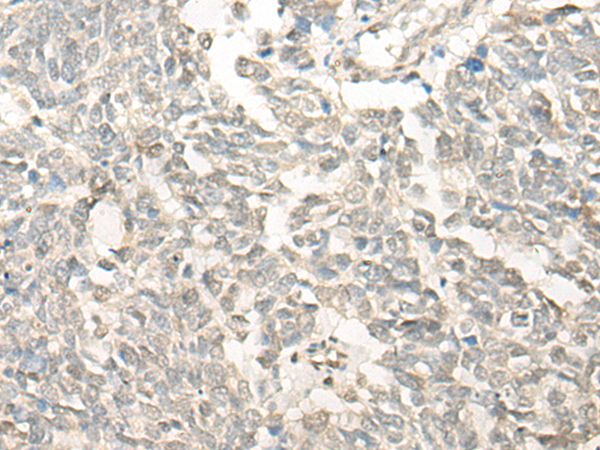 Rabbit Polyclonal Antibody to FSD1