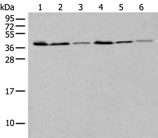 Rabbit Polyclonal Antibody to UBXN1