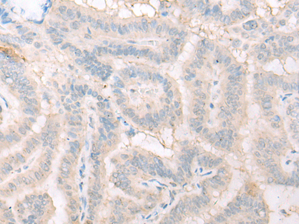 Rabbit Polyclonal Antibody to DHRS1