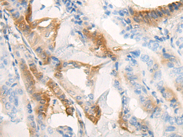 Rabbit Polyclonal Antibody to KCTD17