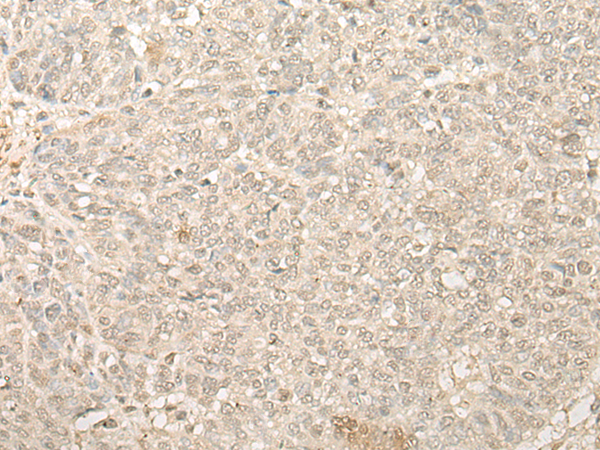 Rabbit Polyclonal Antibody to FYTTD1