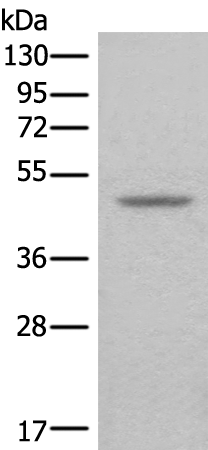 Rabbit Polyclonal Antibody to MAGEA11