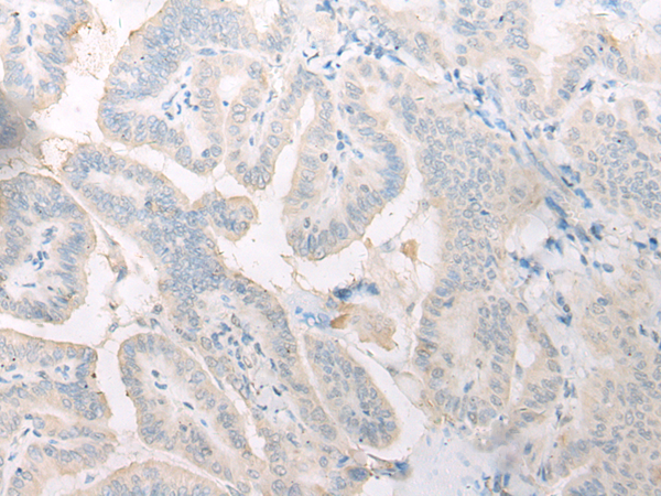 Rabbit Polyclonal Antibody to MLST8