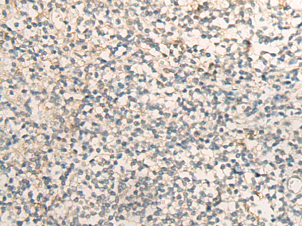Rabbit Polyclonal Antibody to EIF2S2