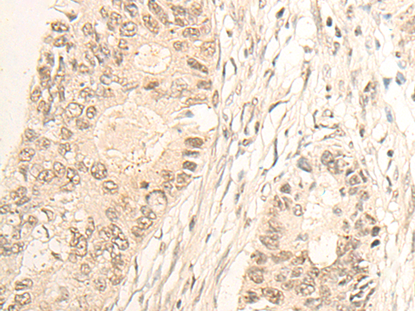 Rabbit Polyclonal Antibody to SLFN5