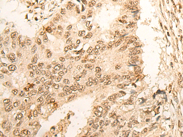 Rabbit Polyclonal Antibody to POLR1C