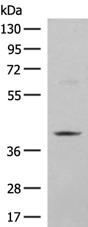 Rabbit Polyclonal Antibody to HMG20A