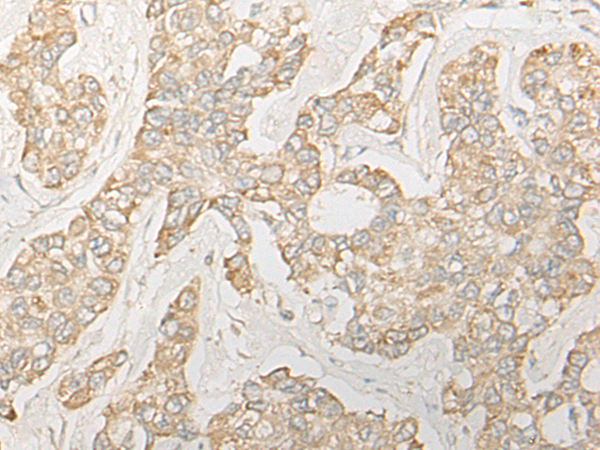 Rabbit Polyclonal Antibody to RSPH14