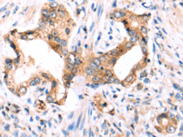 Rabbit Polyclonal Antibody to MRPL3