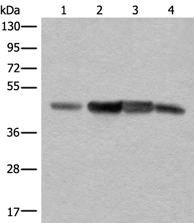 Rabbit Polyclonal Antibody to A4GALT