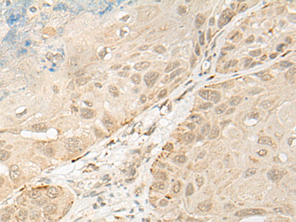 Rabbit Polyclonal Antibody to OTX1