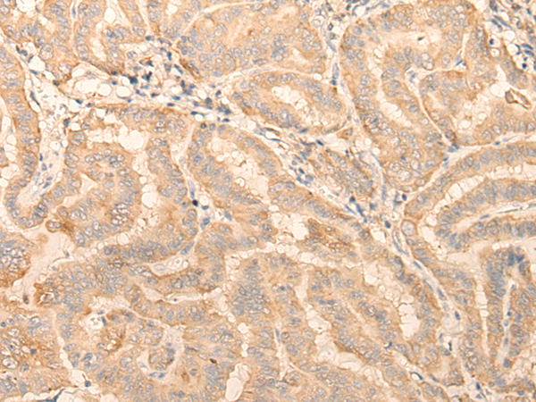 Rabbit Polyclonal Antibody to OTULINL