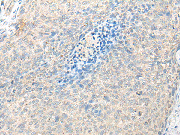 Rabbit Polyclonal Antibody to STOML2