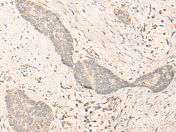Rabbit Polyclonal Antibody to RNF146