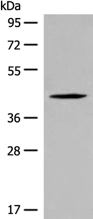Rabbit Polyclonal Antibody to QTRT1