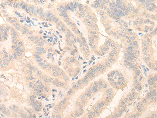 Rabbit Polyclonal Antibody to HMBS