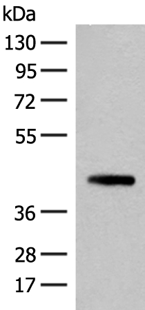 Rabbit Polyclonal Antibody to SMS