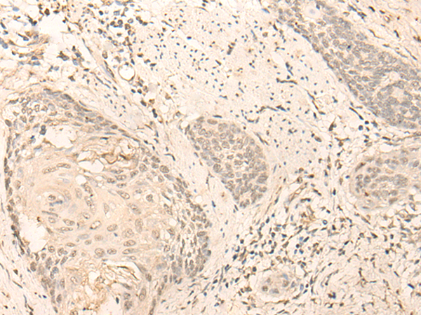 Rabbit Polyclonal Antibody to ZNF707