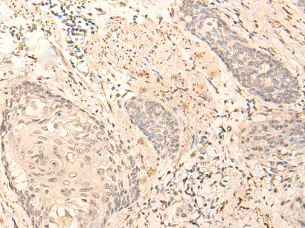 Rabbit Polyclonal Antibody to TADA3
