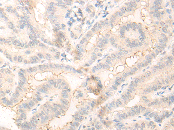 Rabbit Polyclonal Antibody to RADIL