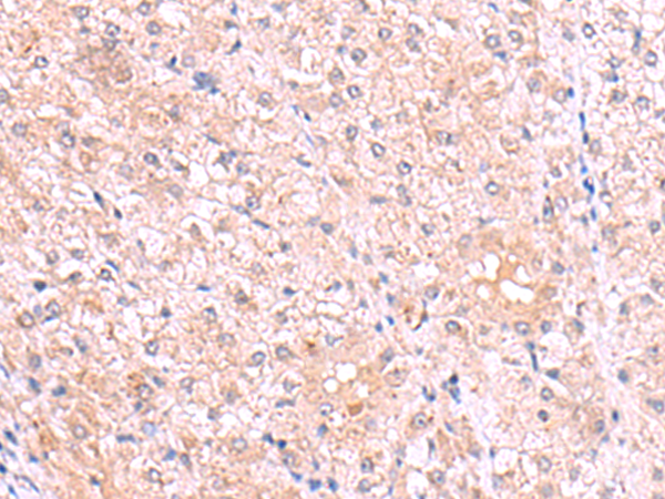 Rabbit Polyclonal Antibody to PISD