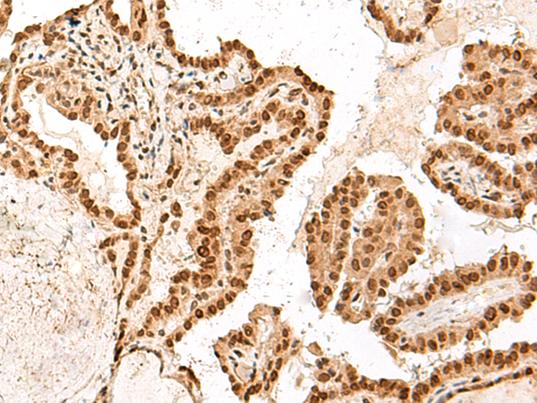 Rabbit Polyclonal Antibody to ARMC8