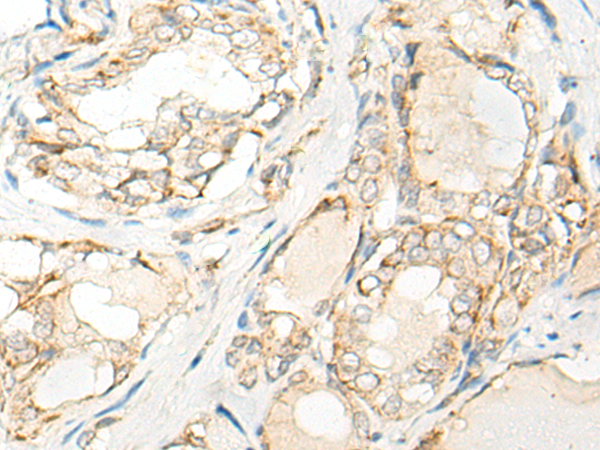 Rabbit Polyclonal Antibody to TTC4