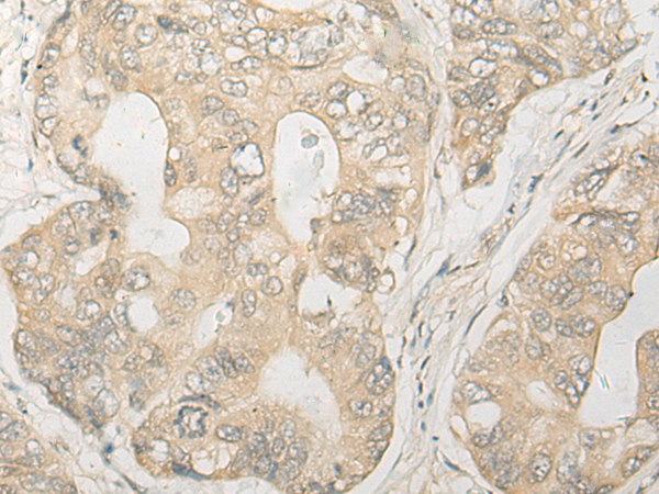 Rabbit Polyclonal Antibody to PSMC4