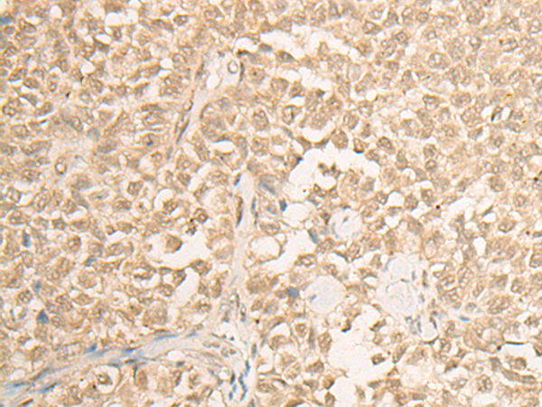 Rabbit Polyclonal Antibody to PSMC6