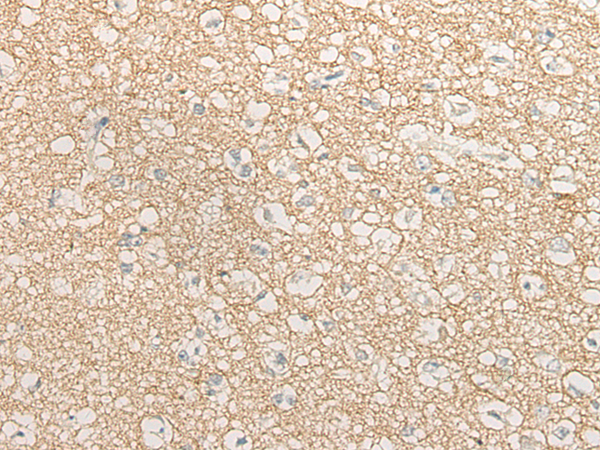 Rabbit Polyclonal Antibody to BCAS3