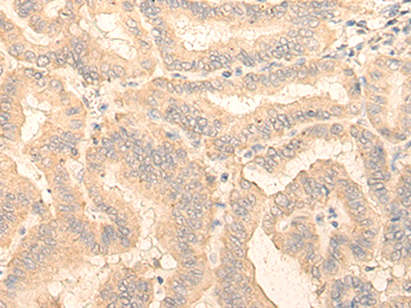Rabbit Polyclonal Antibody to RGP1