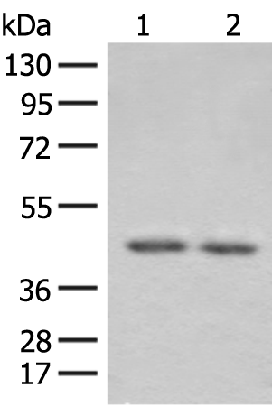 Rabbit Polyclonal Antibody to ILKAP