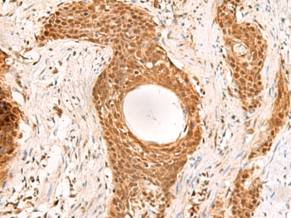 Rabbit Polyclonal Antibody to RMND5B