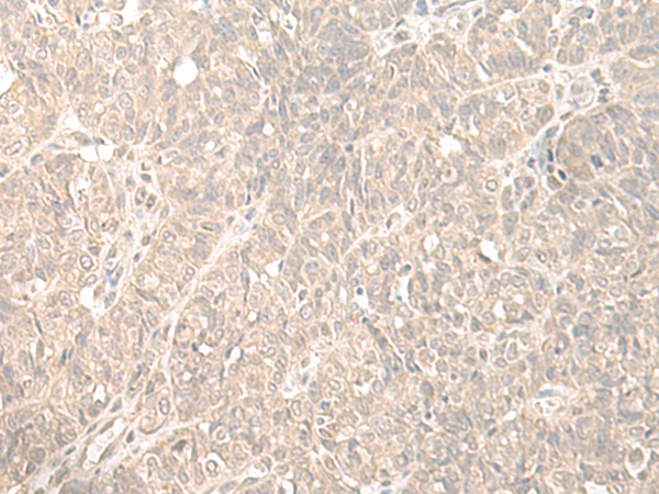 Rabbit Polyclonal Antibody to HENMT1