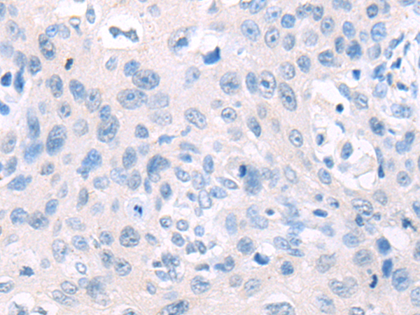 Rabbit Polyclonal Antibody to TCN2
