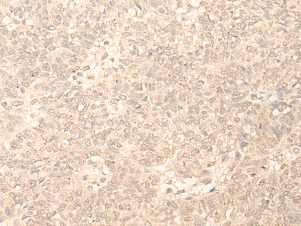Rabbit Polyclonal Antibody to PLEKHA1