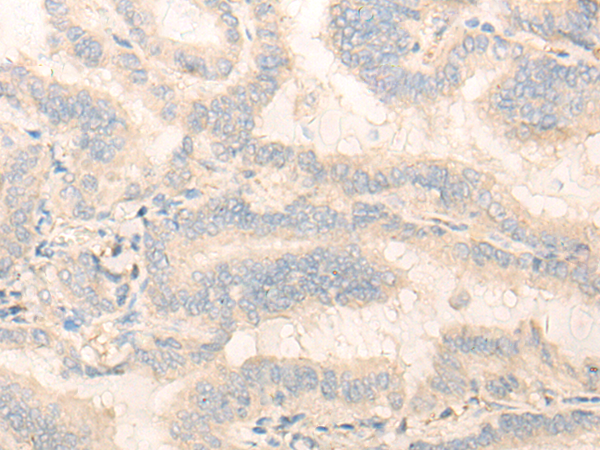 Rabbit Polyclonal Antibody to OLFML3