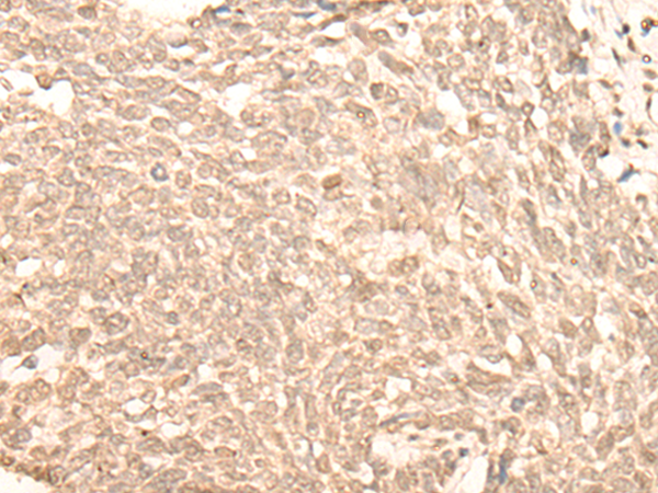 Rabbit Polyclonal Antibody to NARF