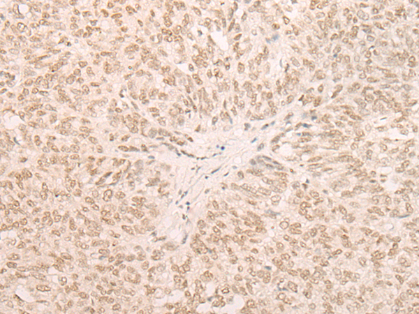 Rabbit Polyclonal Antibody to EIF4A3