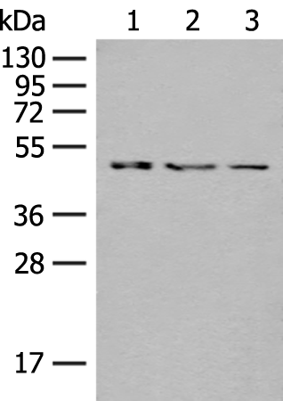 Rabbit Polyclonal Antibody to GCDH