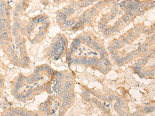 Rabbit Polyclonal Antibody to GCNT3