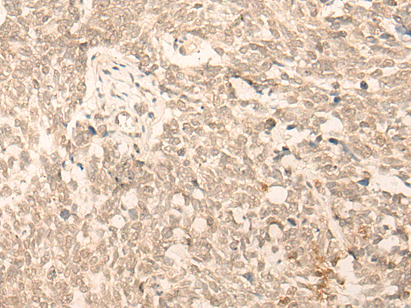 Rabbit Polyclonal Antibody to IFRD2