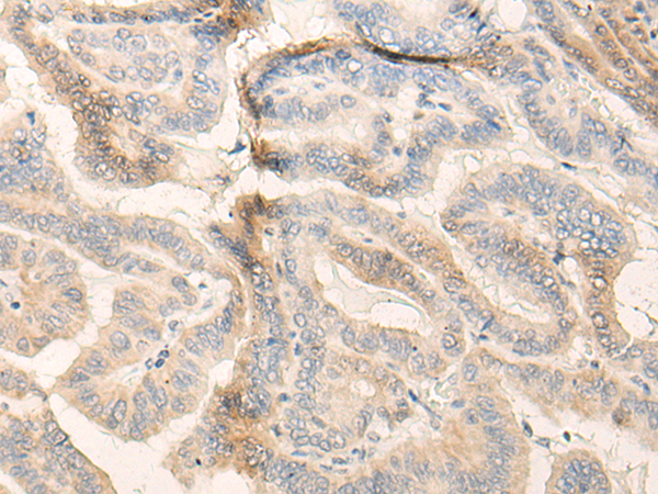 Rabbit Polyclonal Antibody to FADS3