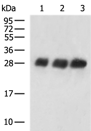 Rabbit Polyclonal Antibody to SARS-CoV-2 S1